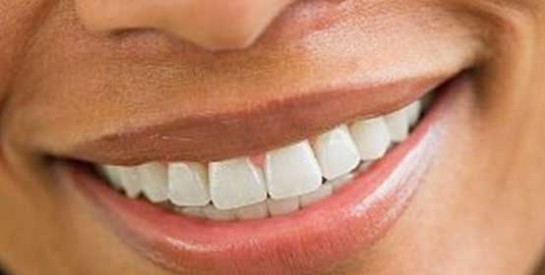 Blanchiment dentaire : un beau sourire à haut risque