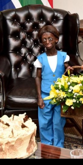 Afrique du sud : Ontlametse Phalatse, atteinte de Progeria, elle rêvait de voir le président