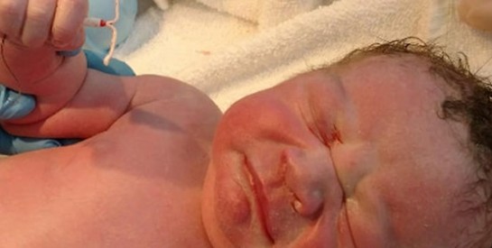 Etats-Unis : elle fait poser son nouveau-né avec le stérilet qui aurait dû l`empêcher de venir au monde