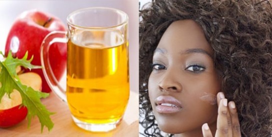 Le vinaigre de cidre : un remède vraiment surprenant pour traiter l`acné et les taches du visage!