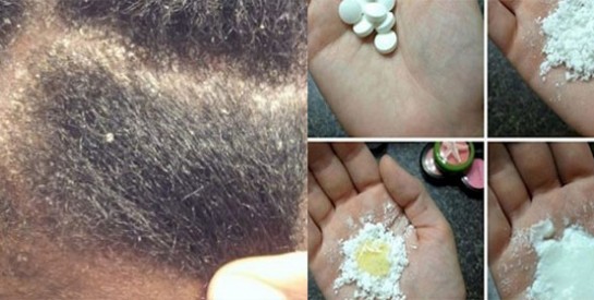 L’aspirine pour combattre les pellicules et prendre soin des cheveux