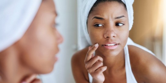 Ces mauvaises habitudes responsables de votre acné