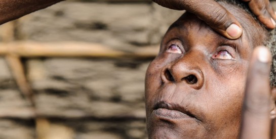 Le trachome :  les femmes sont plus touchées par cette cécité d’origine infectieuse que les hommes