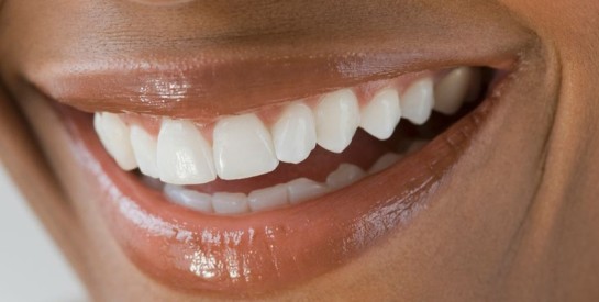 Les effets secondaires du blanchiment des dents