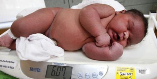 Macrosomie foetale : quand on attend un "gros" bébé