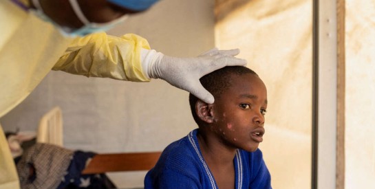 Les enfants victimes de l'épidémie de mpox