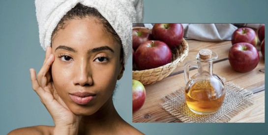 Le vinaigre de cidre : un allié naturel pour réduire les boutons et les imperfections