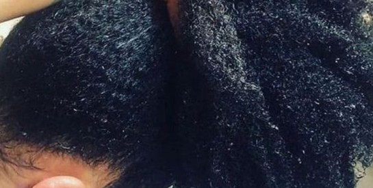 Cheveux crépus : ces habitudes qui fragilisent vos longueurs sans que vous le sachiez