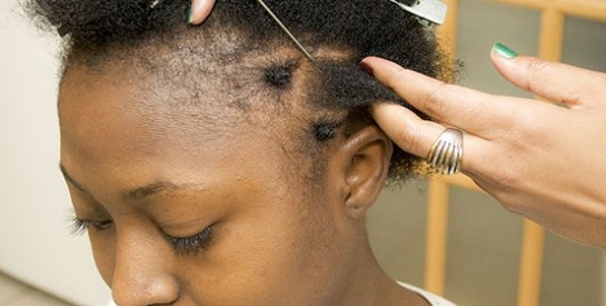 Pourquoi les cheveux de types africains se cassent-ils?