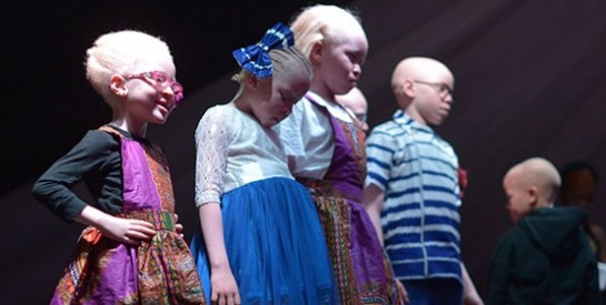 Kenya : les albinos ont leur concours de beauté pour lutter contre les préjugés